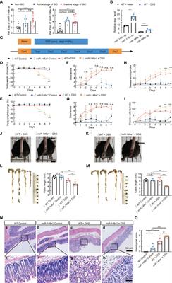 MiR-146a alleviates inflammatory bowel disease in mice through systematic regulation of multiple genetic networks